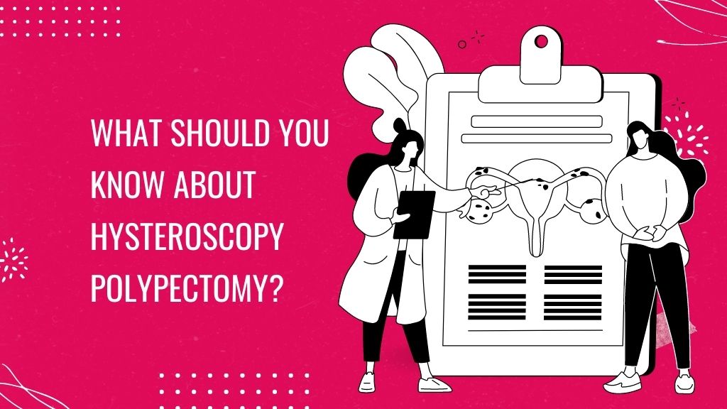 hysteroscopy polypectomy